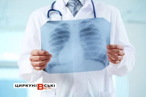 Флюорографію для жителів Липецької та Циркунівської громад проведуть 2 листопада в Циркунах: знадобляться направлення та попередній запис на порталі Gromada Group