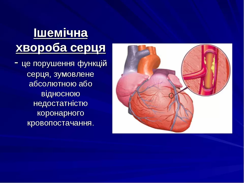 Протягом усієї історії незалежної України смертність у нашій країні перевищує народжуваність. За даними Державної служби статистики України, лише в 1991 році різниця між смертністю та народжуваністю була невелика: на 1000 осіб було 12,1 народжених, 12,9 померлих.